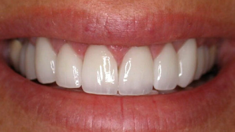 3 tips to have fantastically white teeth