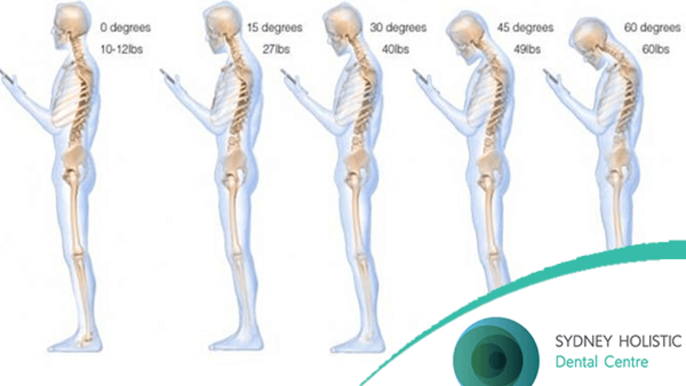 The problem with postural stress