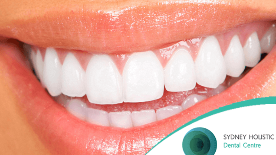 Hygienist Advice: Tooth Whitening