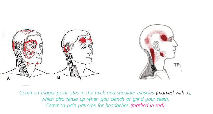 Dental connection