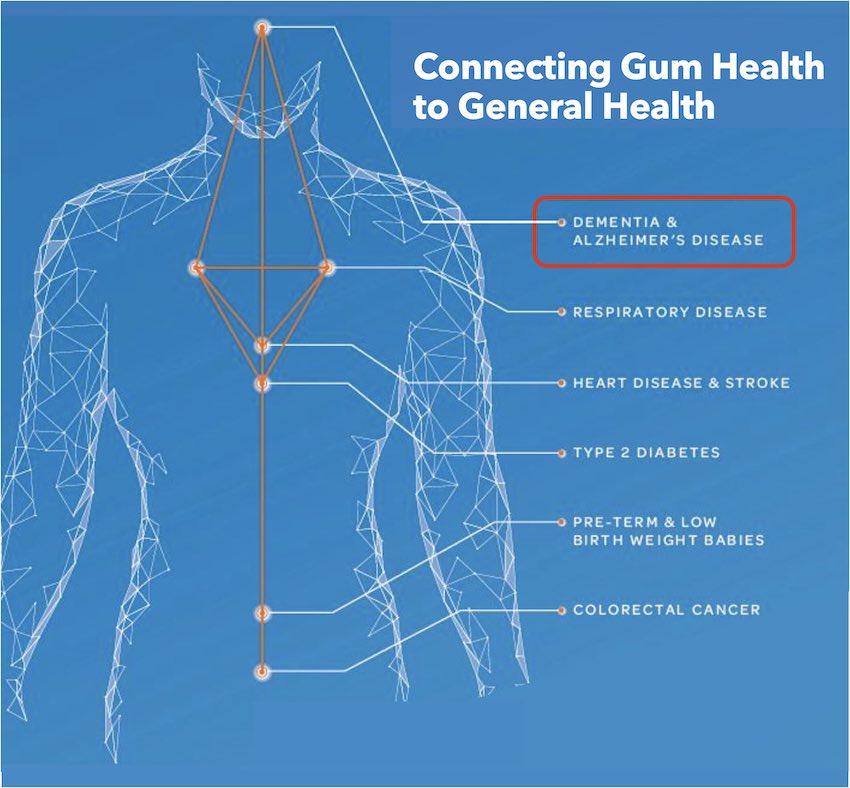 Gum Health and General Health