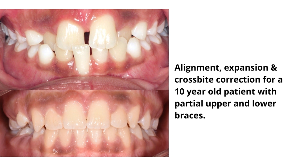 The Holistic Dentist&#8217;s Approach to Orthodontics