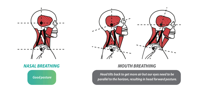 Mouth-Breathing-Head-Forward-Posture mouth breathing